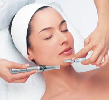 Microneedling