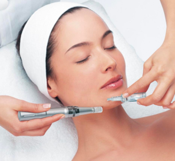 Microneedling