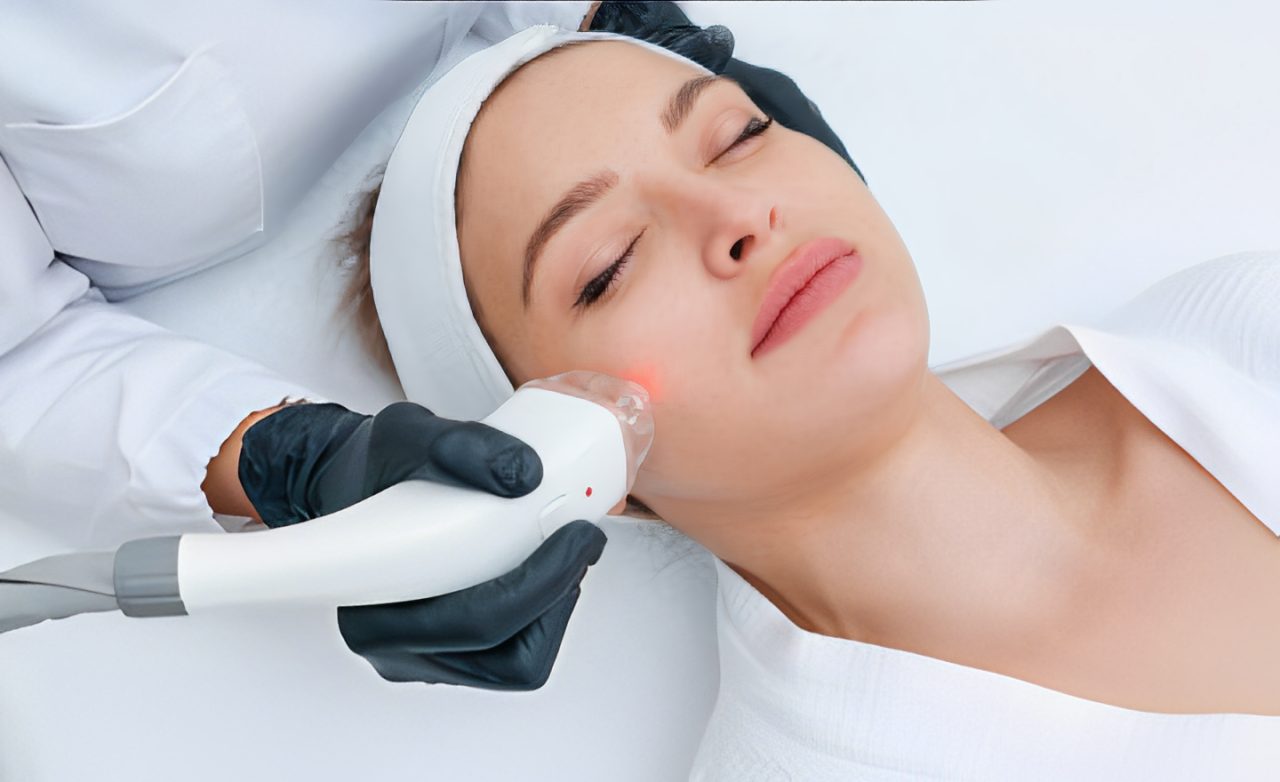 Pigmentation & Birth Marks Treatment