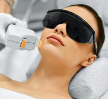 Intense Pulsed Light (IPL)